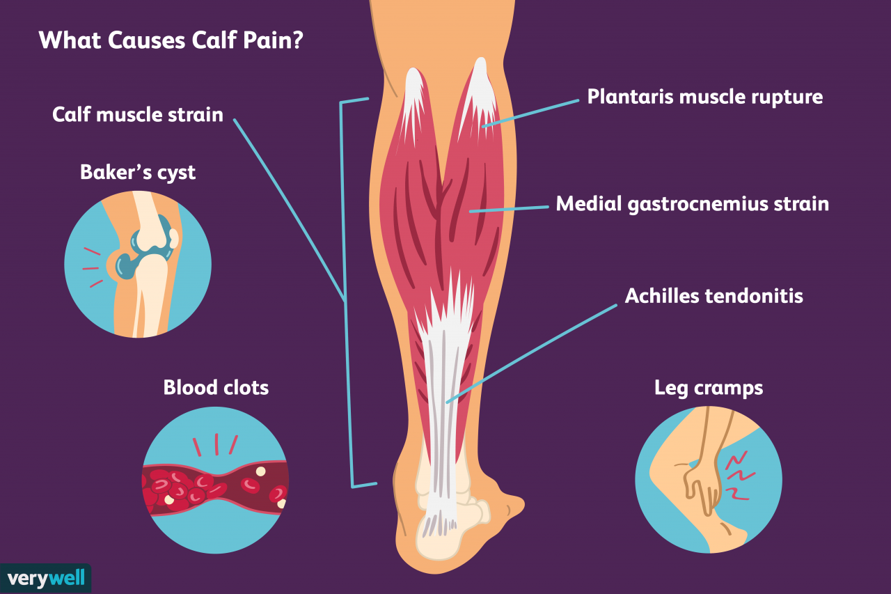 Calf pain causes muscle treat back strain when treatment common leg lower calves knee sore ankle do between pains sprains